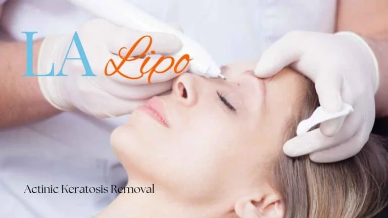 Woman receiving Actinic Keratosis Removal Treatment Wentworth