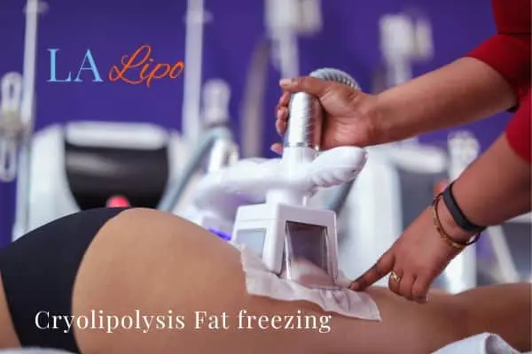 women getting fat freezing Wentworth