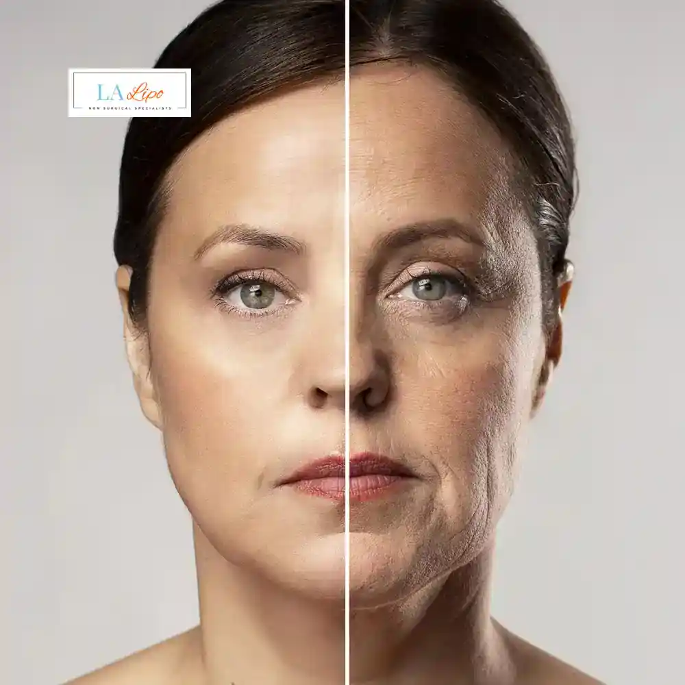How Can You Tell If Non-Surgical Skin Tightening Is Right for You Wentworth?