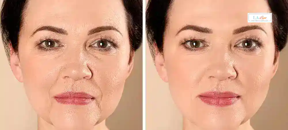 Why Aren’t My Skincare Products Making My Sagging Skin Look Firmer Wentworth?