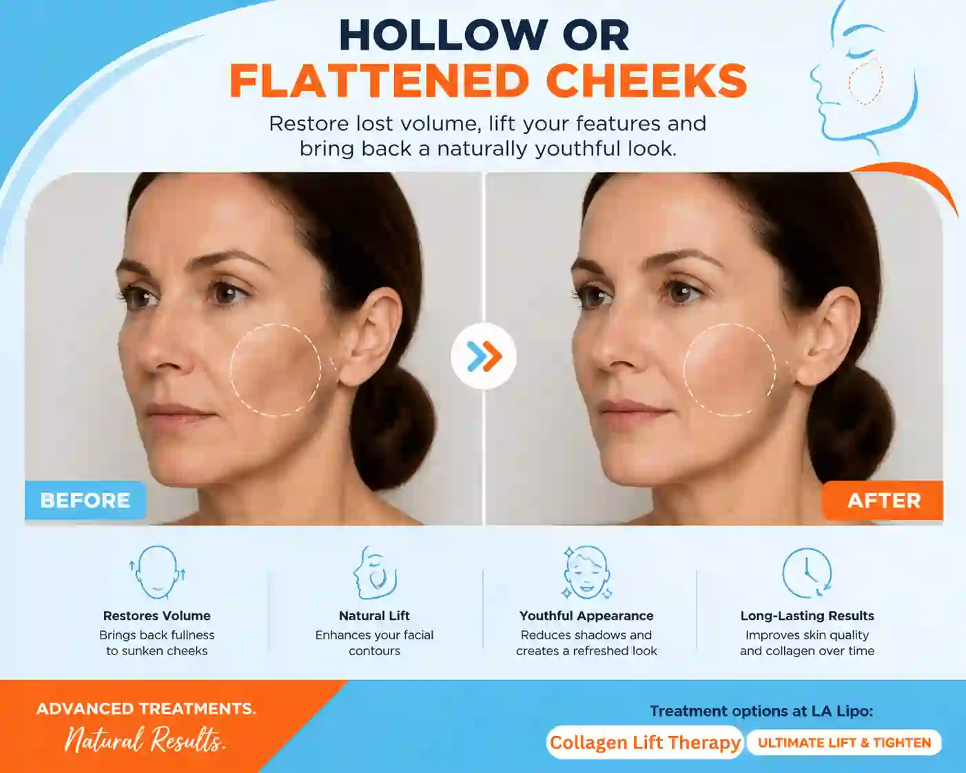 Sign #4: Hollow or Flattened Cheeks Wentworth