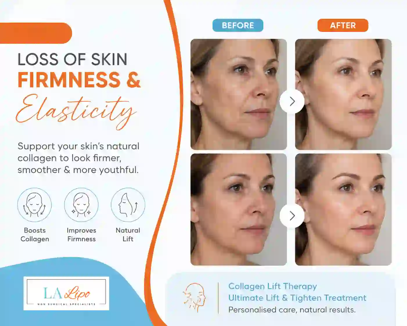 Sign #7: Loss of Skin Firmness and Elasticity Wentworth